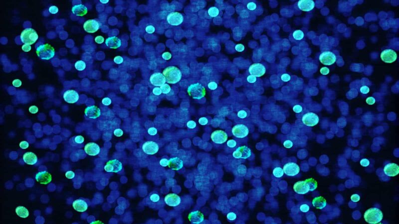 Microbiome affects our ADHD brains too